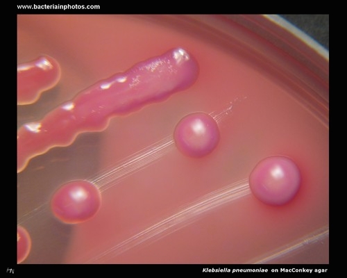klebsiella on macconkey agar